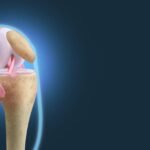 joint health